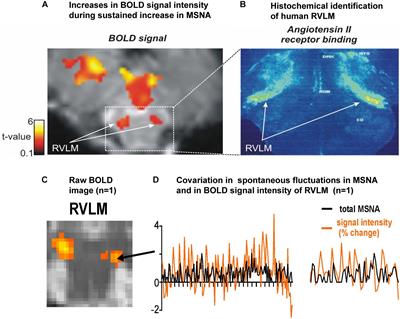 Identifying Increases in Activity of the Human RVLM Through MSNA-Coupled fMRI